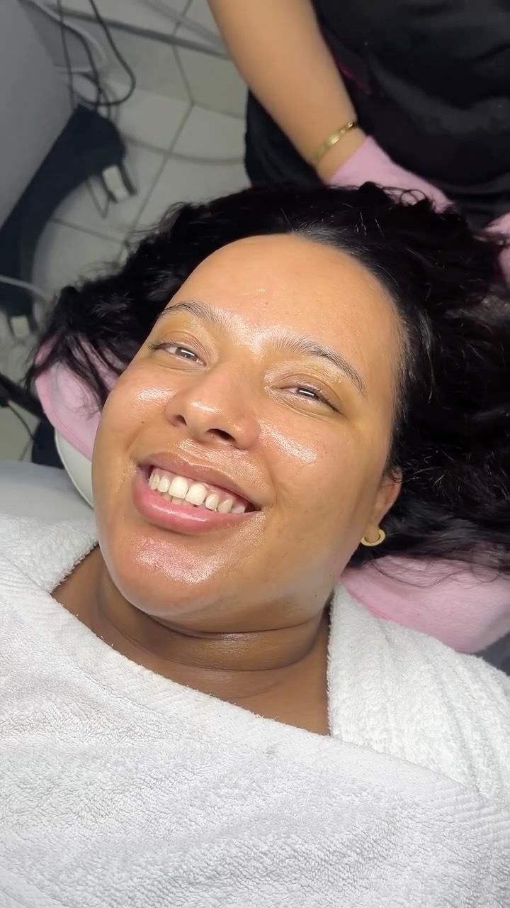 Résultat soin visage